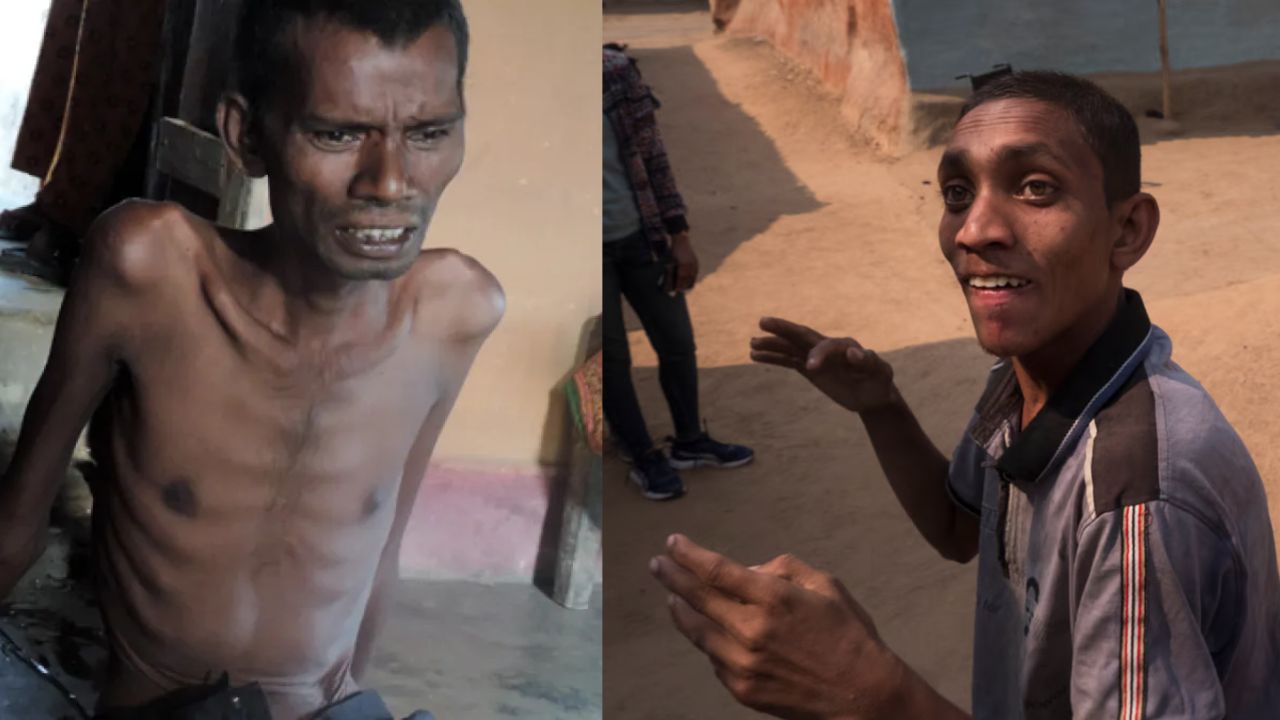 Jadugora: झारखण्ड के इस गांव को लगा यूरेनियम का श्राप, बच्चे विकलांग और बूढ़ों को हो रहा कैंसर